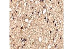 Immunohistochemistry (IHC) image for anti-Sprouty-Related, EVH1 Domain Containing 1 (SPRED1) (Middle Region 1) antibody (ABIN1031192) (SPRED1 anticorps  (Middle Region 1))