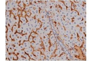 ABIN6267323 at 1/200 staining Mouse liver tissue sections by IHC-P.