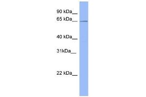 WB Suggested Anti-METTL3 Antibody Titration:  0. (METTL3 anticorps  (Middle Region))