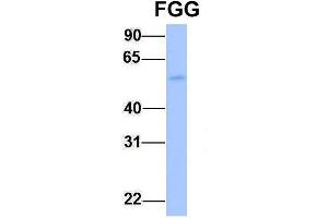 Host:  Rabbit  Target Name:  FGG  Sample Type:  Human Fetal Liver  Antibody Dilution:  1. (FGG anticorps  (Middle Region))