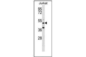 Western blot analysis of RBM22 Antibody  in Jurkat cell line lysates (35ug/lane).