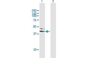 Western Blot analysis of SERPINA5 expression in transfected 293T cell line by SERPINA5 MaxPab polyclonal antibody. (SERPINA5 anticorps  (AA 1-406))