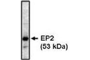 Western blot analysis using EP2 antibody on bovine brain lysate at 1 µg/ml. (PTGER2 anticorps)