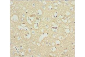 Immunohistochemistry of paraffin-embedded human brain tissue using ABIN7161255 at dilution of 1:100 (NCALD anticorps  (AA 1-193))