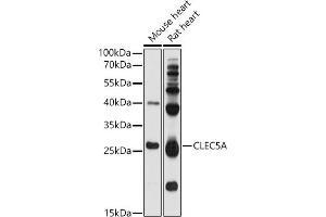 Western blot analysis of extracts of various cell lines, using CLEC5A antibody (ABIN1679280, ABIN1679281, ABIN5664169 and ABIN6219863) at 1:1000 dilution. (CLEC5A anticorps  (AA 29-188))