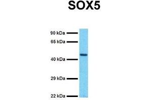 Host:  Rabbit  Target Name:  SOX5  Sample Tissue:  Human MCF7  Antibody Dilution:  1.