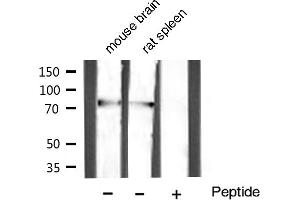 Western blot analysis of extracts of various celllines,using GRP78 Antibody (GRP78 anticorps)