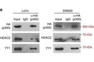 miR-500a-5p expression is up-regulated via the YY1/p300/HDAC2 complex. (HDAC2 anticorps  (C-Term))