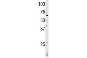 Western blot analysis of CYP1A1 antibody and mouse lung tissue lysate