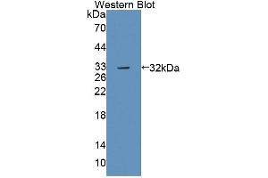 Detection of Recombinant PTPRB, Mouse using Polyclonal Antibody to Protein Tyrosine Phosphatase Receptor Type B (PTPRB)