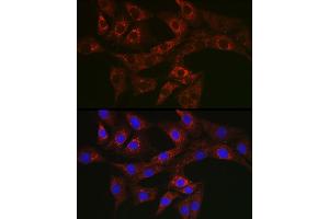 Immunofluorescence analysis of NIH/3T3 cells using A Rabbit pAb (ABIN3023408, ABIN3023409, ABIN3023410 and ABIN6219712) at dilution of 1:50 (40x lens). (ATG4A anticorps  (AA 289-398))