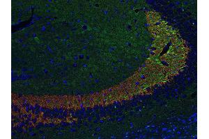 Indirect immunostaining of PFA fixed paraffin embedded mouse hippocampus section with anti-Synaptoporin (dilution 1 : 500; red) and chicken anti-Tau (cat.
