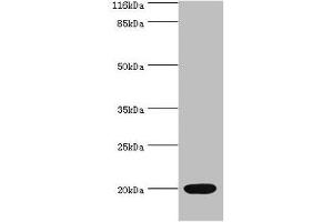 Western blot All lanes: NTS antibody at 2 μg/mL + Mouse small intestine tissue Secondary Goat polyclonal to rabbit IgG at 1/10000 dilution Predicted band size: 20 kDa Observed band size: 20 kDa (Neurotensin anticorps  (AA 24-143))