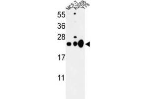 Western Blotting (WB) image for anti-Chromobox Homolog 1 (CBX1) antibody (ABIN3003963)