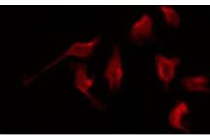 ABIN6276061 staining NIH-3T3 by IF/ICC. (NPY1R anticorps  (Internal Region))