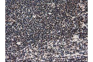 Image no. 7 for anti-Nonhomologous End-Joining Factor 1 (NHEJ1) antibody (ABIN1499729) (NHEJ1 anticorps)