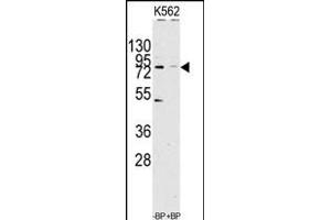 Western blot analysis of anti-JHDM1a/FBXL11 Antibody (C-term) (ABIN1536624 and ABIN2844141) pre-incubated with(right lane) and without(left lane) blocking peptide in Jurkat cell line lysate. (KDM2A anticorps  (C-Term))