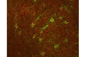 Indirect immunostaining of a PFA fixed mouse cortex section with anti-Kv 3.