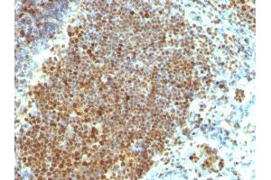 Image no. 2 for anti-Proliferating Cell Nuclear Antigen (PCNA) antibody (ABIN6166296) (PCNA anticorps)