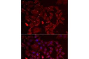 Immunofluorescence analysis of MCF7 cells using ADSS Polyclonal Antibody (ADSS anticorps)