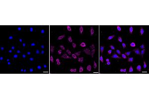 Immunocytochemical staining of Hela cells with Keratin 13 antibody (ABIN7799165), 1:1,000).