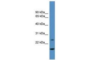Image no. 1 for anti-Tissue Factor Pathway Inhibitor 2 (TFPI2) (AA 21-70) antibody (ABIN6745333) (TFPI2 anticorps  (AA 21-70))