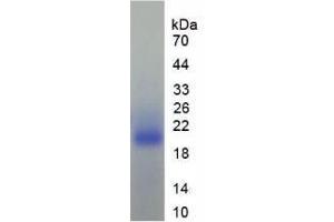 SDS-PAGE analysis of Human TGFb1I1 Protein.