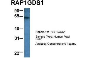 Host: Rabbit  Target Name: RAP1GDS1  Sample Tissue: Human Fetal Brain  Antibody Dilution: 1. (RAP1GDS1 anticorps  (Middle Region))