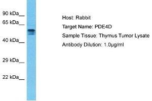 Host: Rabbit Target Name: PDE4D Sample Type: Thymus Tumor lysates Antibody Dilution: 1. (PDE4D anticorps  (C-Term))