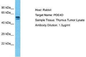 Host: Rabbit Target Name: PDE4D Sample Type: Thymus Tumor lysates Antibody Dilution: 1.