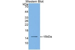 Western blot analysis of the recombinant protein. (Angiotensin I Converting Enzyme 1 anticorps  (AA 334-409))