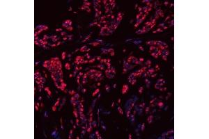 IF analysis of SNRPN using anti-SNRPN antibody (ABIN3043934). (SNRPN anticorps  (N-Term))