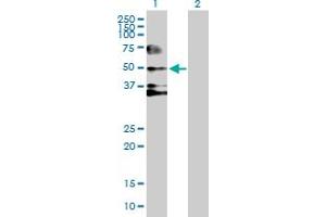 Western Blot analysis of SERPIND1 expression in transfected 293T cell line by SERPIND1 MaxPab polyclonal antibody.