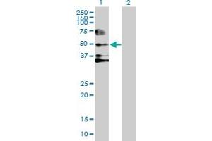 Western Blot analysis of SERPIND1 expression in transfected 293T cell line by SERPIND1 MaxPab polyclonal antibody. (SERPIND1 anticorps  (AA 1-499))
