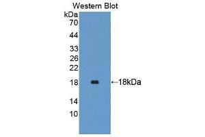 Western blot analysis of the recombinant protein. (TRAPPC2 anticorps  (AA 1-140))