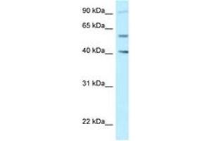 Image no. 1 for anti-SHC SH2-Domain Binding Protein 1-Like (SHCBP1L) (AA 525-574) antibody (ABIN6747880) (SHCBP1L anticorps  (AA 525-574))