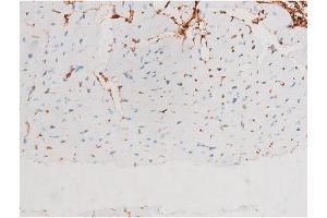 ABIN6267528 at 1/200 staining Mouse heart tissue sections by IHC-P. (SAPK, JNK (pThr183) anticorps)