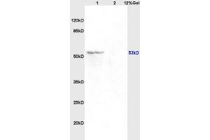 Lane 1: mouse brain lysates Lane 2: rat kidney lysates probed with Anti Acetyl-p53(K382) Polyclonal Antibody, Unconjugated (ABIN729673) at 1:200 in 4 °C.