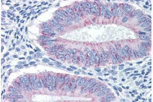 Human Uterus: Formalin-Fixed, Paraffin-Embedded (FFPE)