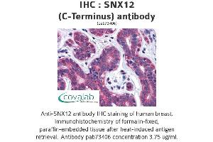 Image no. 2 for anti-Sorting Nexin 12 (SNX12) (C-Term) antibody (ABIN1739487) (SNX12 anticorps  (C-Term))