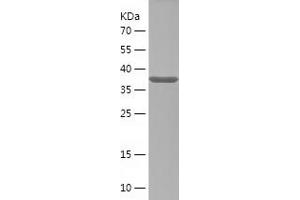 Western Blotting (WB) image for serine/threonine Kinase 32A (STK32A) (AA 258-396) protein (His-IF2DI Tag) (ABIN7125043)