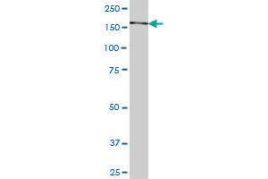 SNAPC4 monoclonal antibody (M04), clone 4G5 Western Blot analysis of SNAPC4 expression in HepG2 .