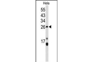 Western blot analysis of CENPH Antibody in Hela cell line lysates (35ug/lane) (CENPH anticorps  (AA 136-162))