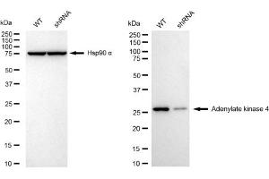 Western blotting analysis using Adenylate kinase 4 antibody (ABIN7797522). (Recombinant AK4 anticorps)