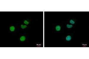 ICC/IF Image Retinoic Acid Receptor gamma antibody detects Retinoic Acid Receptor gamma protein at nucleus by immunofluorescent analysis. (Retinoic Acid Receptor gamma anticorps)