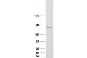 Validation with Western Blot