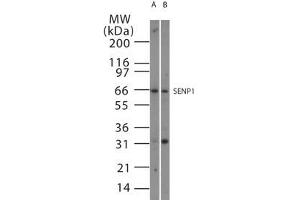 Image no. 1 for anti-SUMO1/sentrin Specific Peptidase 1 (SENP1) (AA 578-590) antibody (ABIN208752) (SENP1 anticorps  (AA 578-590))