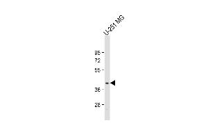Anti-PNPLA5 Antibody (Center) at 1:2000 dilution + U-251 MG whole cell lysate Lysates/proteins at 20 μg per lane. (PNPLA5 anticorps  (AA 138-168))
