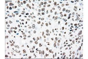 Image no. 1 for anti-Polo-Like Kinase 1 (PLK1) antibody (ABIN1500282)