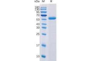 Human CTLA-4 Protein, mFc-His Tag on SDS-PAGE under reducing condition.